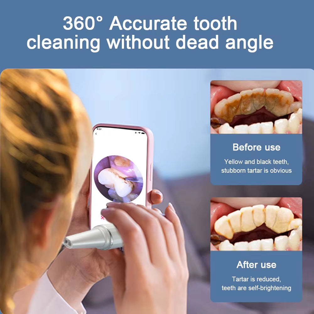 Visual Ultrasonic Scalers Dental Remover for Whitening Teeth Electric Sonic Tooth Cleaner Removal Dental Products by Phone APP