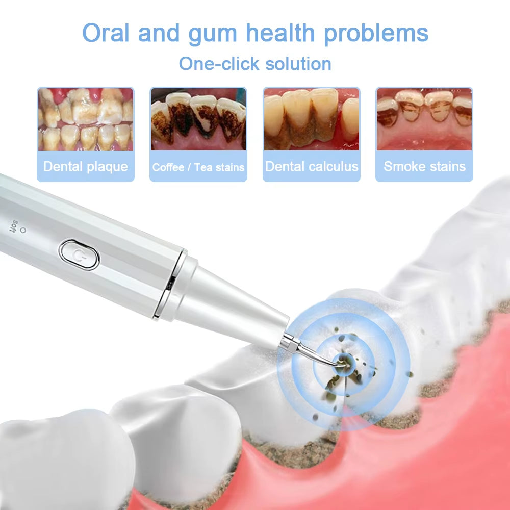 Visual Ultrasonic Scalers Dental Remover for Whitening Teeth Electric Sonic Tooth Cleaner Removal Dental Products by Phone APP